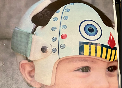 赤ちゃんのヘルメット②－ヘルメット治療の全体の理解